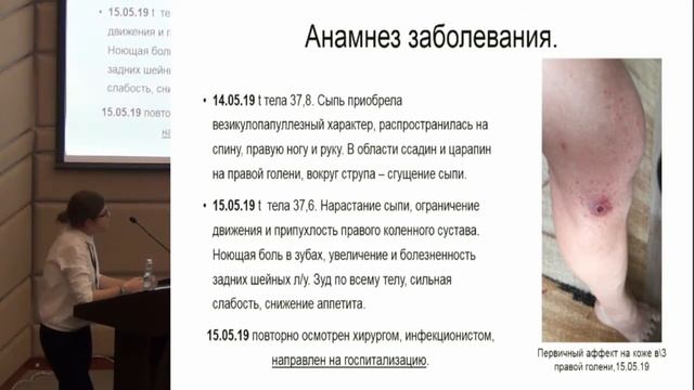 Перекопская Н.Е. «Клинический случай клещевого риккетсиоза» смотреть онлайн