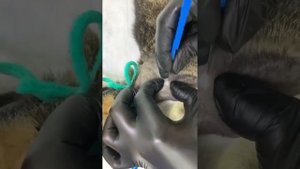 ПОСТАНОВКА ЭЗОФАГОСТОМЫ