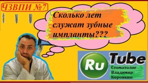 Имплант 8.Сколько лет служат зубные #импланты??Часто задаваемые вопросы по имплантации.#Зуб#имплант