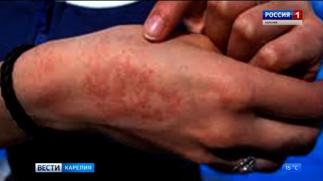 Конференция дерматологов и косметологов Северо-Запада смотреть онлайн