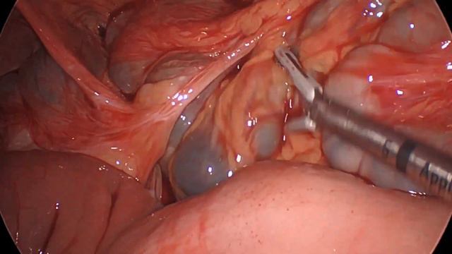 Nice Anatomy Review смотреть онлайн