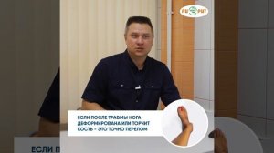 Перелом ноги как определить