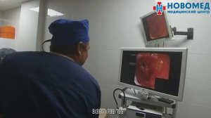 гастроскопия