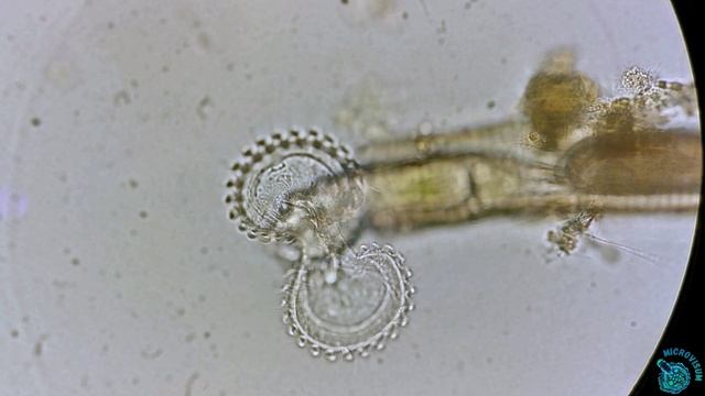Прекрасная коловратка Floscularia