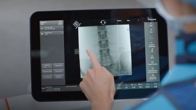 Philips Zenition mobile C-arm Series - Tablet-like User Interface смотреть онлайн