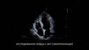 Ультразвуковая система УЗИ-Электрон