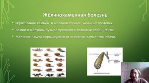 Заболевания органов пищеварения