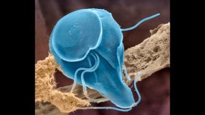 Лямблиоз у детей