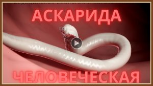 ЛЕЧЕНИЕ АСКАРИДОЗА НАРОДНЫМИ СРЕДСТВАМИ.mp4