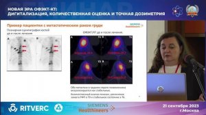Внедрение количественного анализа ОФЭКТ-изображений в клиническую практику