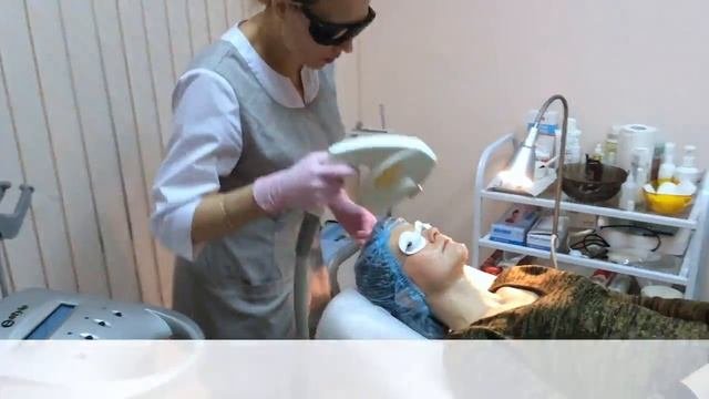 ЭЛОС эпиляция лица
