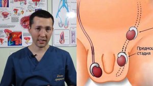 Крипторхизм ва бепуштлик