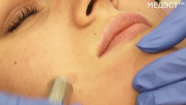 Что такое алмазный пилинг? тм смотреть онлайн