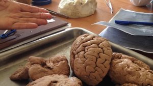 Кора больших полушарий головного мозга.