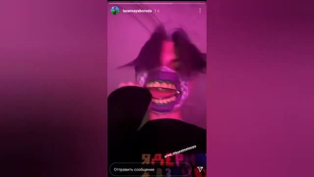 Лазерная борода - побыть ребёнком, новый сниппет!!! смотреть онлайн