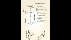 Что лечат Вьетнамской Звездочкой?