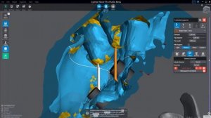 Lychee Slicer 003 - Islands, creating and adjusting supports, parenting, bracing, and more!