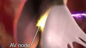 Медицинская анимация. Мерцательная аритмия.