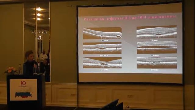 ОКТ- ангиография и ФАГ в выявлении дефектов ПЭ при ЦСХ: сопоставление результатов смотреть онлайн