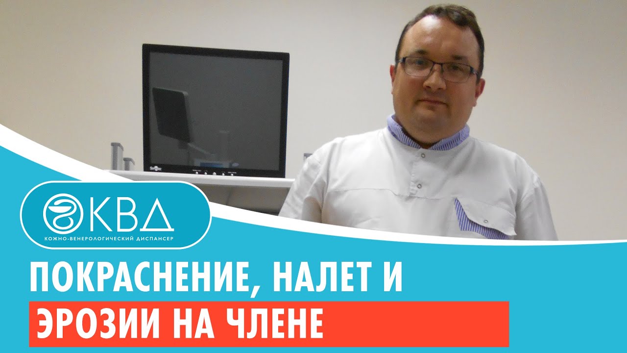 Покраснение, налет и эрозии на члене. Клинический случай №146