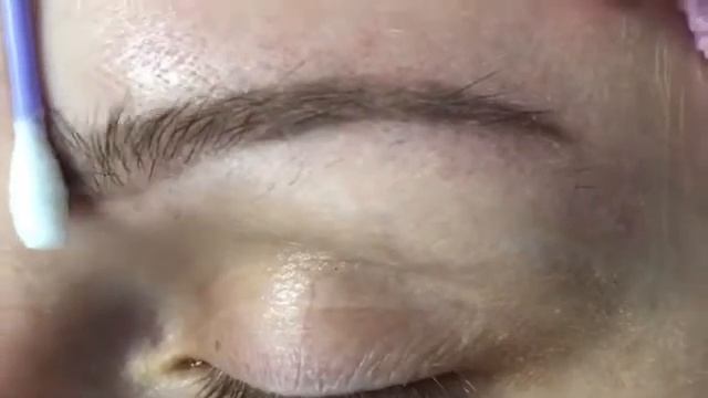 Удаляем старый татуаж бровей смотреть онлайн