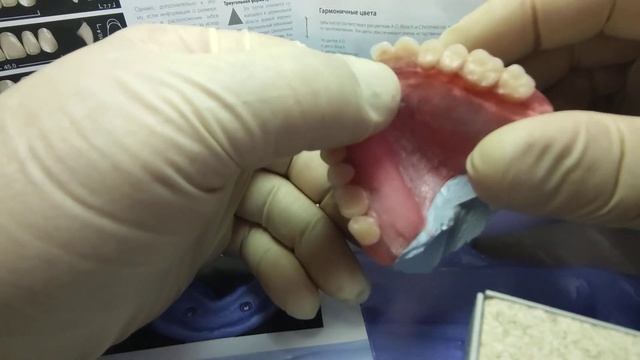 Почему ломаются акриловые протезы? в чëм причина? смотреть онлайн