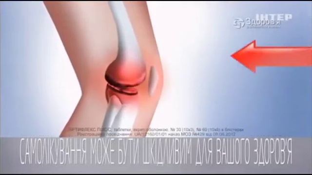 Артифлекс смотреть онлайн