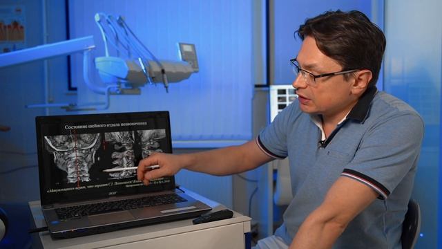 Тотальное протезирование пациента с двусторонним артрозом ВНЧС (в 4-х частях) смотреть онлайн