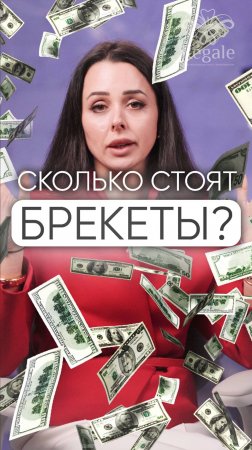 Сколько стоят брекеты? #брекеты #брекетымосква #брекетыцена