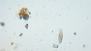 вода из аквариума  под микроскопом
