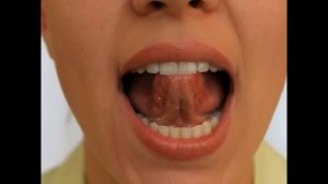 Артикуляционная Гимнастика -  Горка Язык Спортсмен