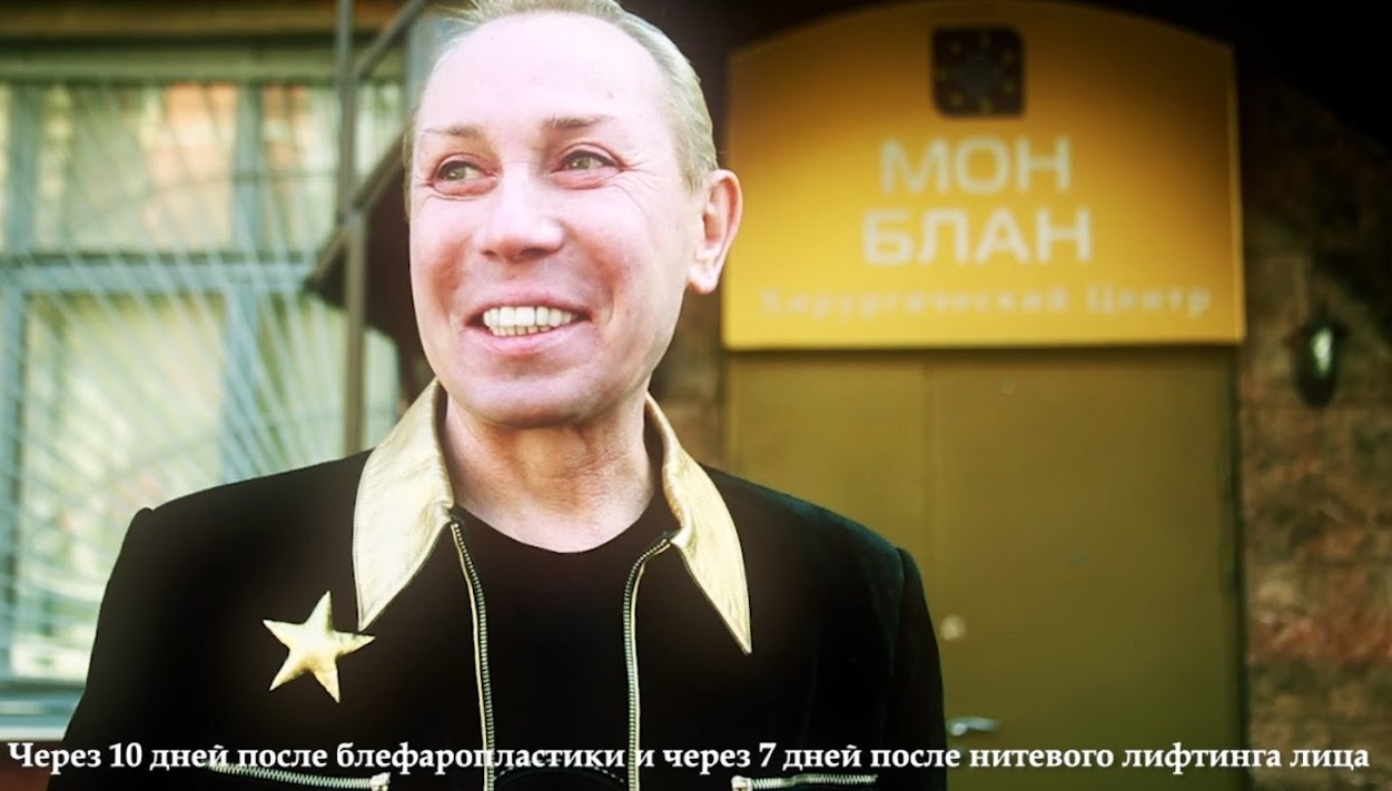 Подтяжка лица нитями Александра Пескова