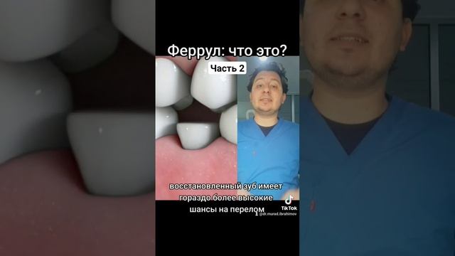 Феррул эффект - Ч.2 #стоматолог #стоматология #протезированиезубов #коронканазуб #коронки #зуб #зуб