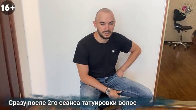 Почему ты не обязан лысеть. Трихопигментация в Москве. Scalp micropigmentation by Andrey Afanasev