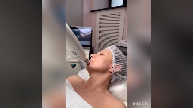 Clearlift смотреть онлайн