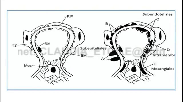 Tmmed histología - 1 4 смотреть онлайн