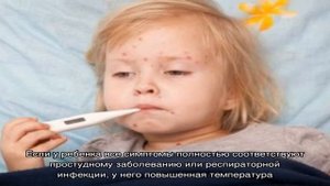 Герпес на теле у ребенка