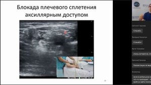 Регионарная анестезия верхней конечности под контролем ультразвука