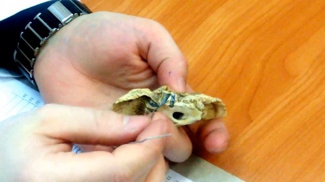 Височная кость смотреть онлайн