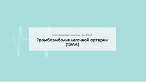 Тромбоэмболия легочной артерии