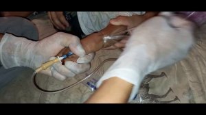 как правильно делать укол в вену ребёнка