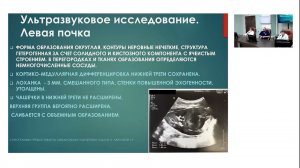 Школа клинического мышления педиатра. Нефробластома у детей. Разбор клинических случаев