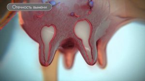 Велактис Эффективное решение для одномоментного запуска