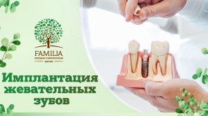 ? Имплантация жевательных зубов