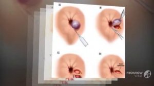 Узнаем все возможные причины болей в заднем проходе у женщины боль отдает в копчик у женщин