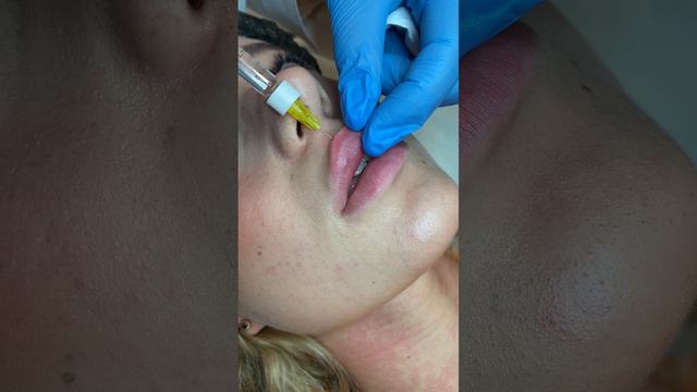 Подкапываем и тянем для выворачивания верхней губы смотреть онлайн