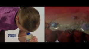 Промывание носа