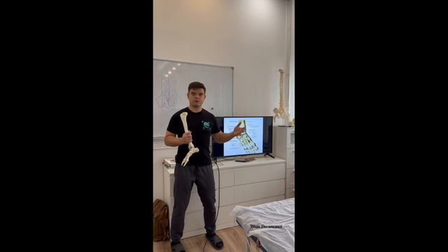 Боль в  стопе, подвывих. Удерживатели сухожилий.