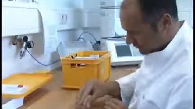 Установка зубного импланта смотреть онлайн