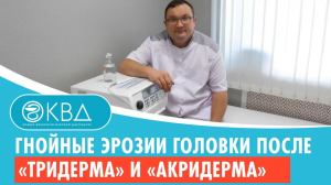 ? Гнойные эрозии головки после «Тридерма» и «Акридерма». Клинический случай №462